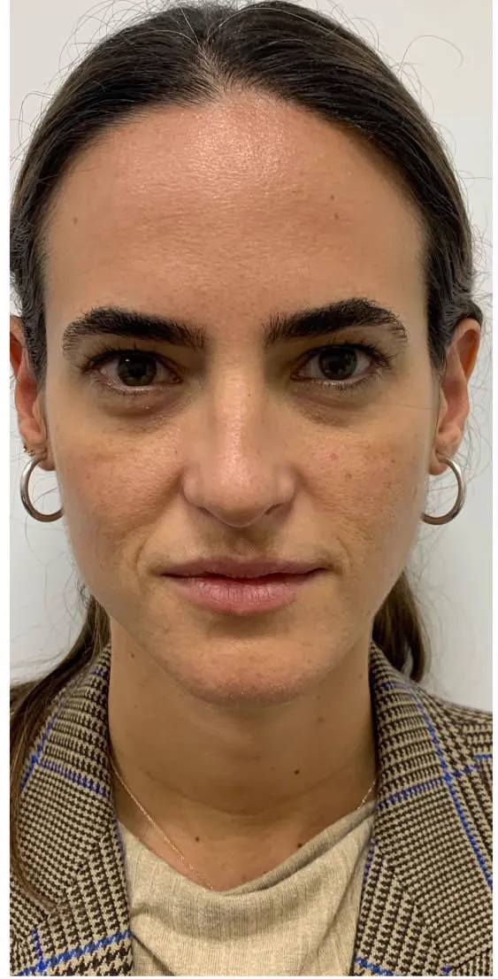 Sandra, paciente de la clínica